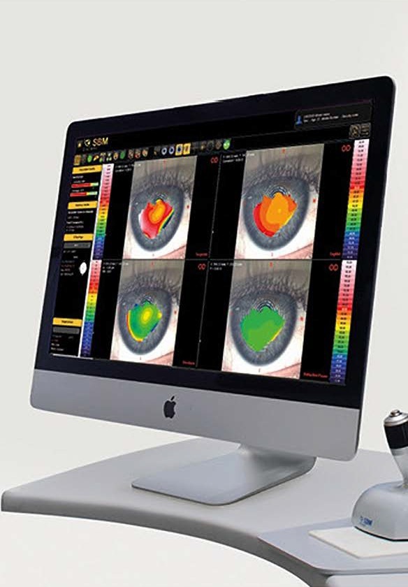Dry Eye Assessment